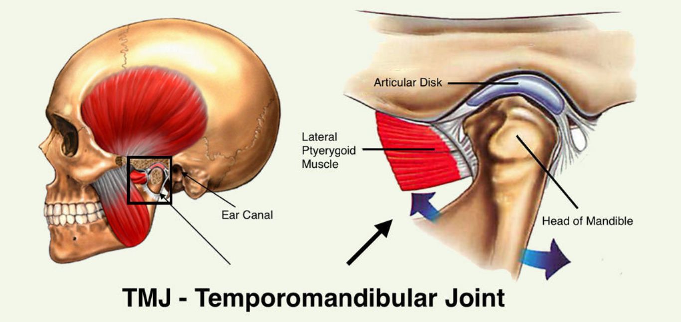 do-you-suffer-from-persistent-jaw-problems