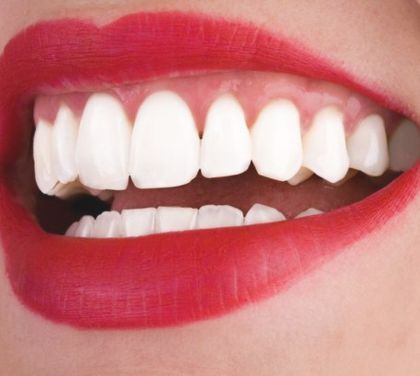 get-pearly-white-teeth-with-teeth-whitening-procedure