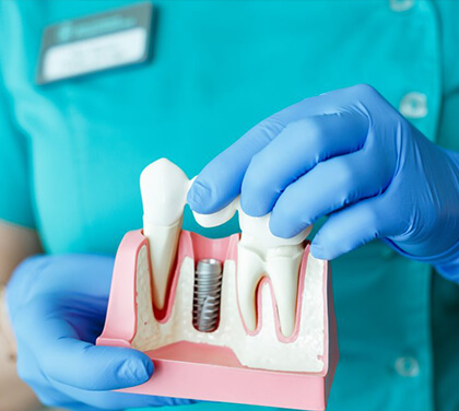 how-to-mentally-prepare-yourself-for-dental-implants