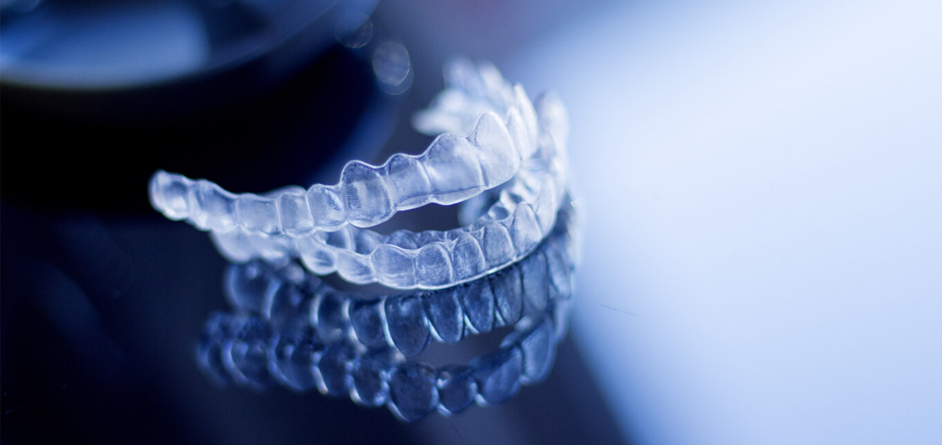 what-are-the-benefits-of-invisalign