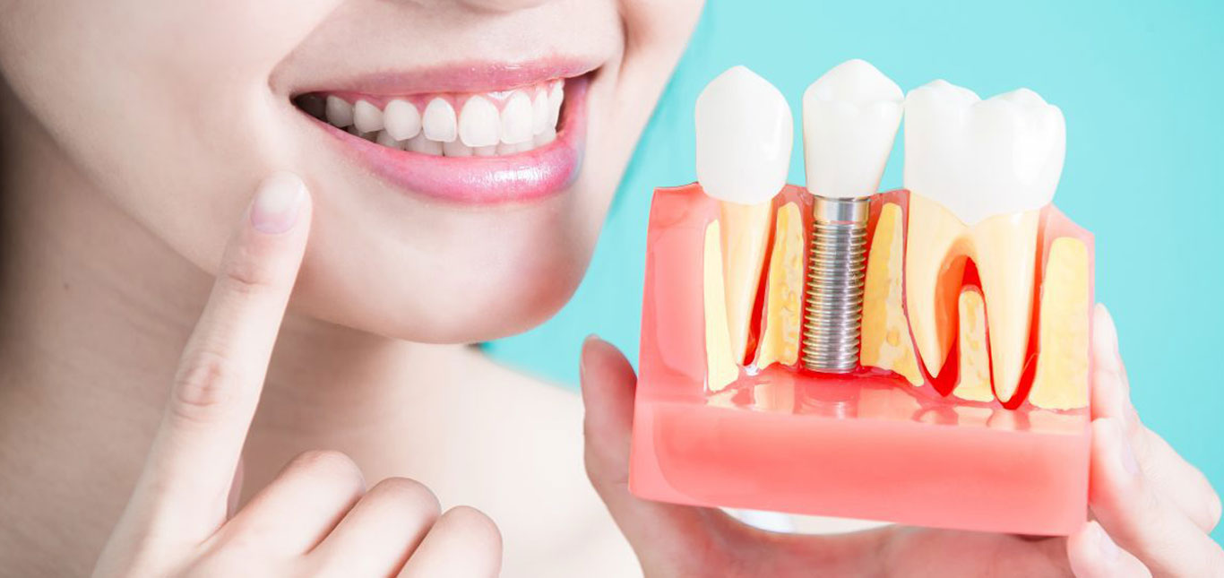 what-happens-during-a-dental-implant-procedure-and-how-much-does-it-cost