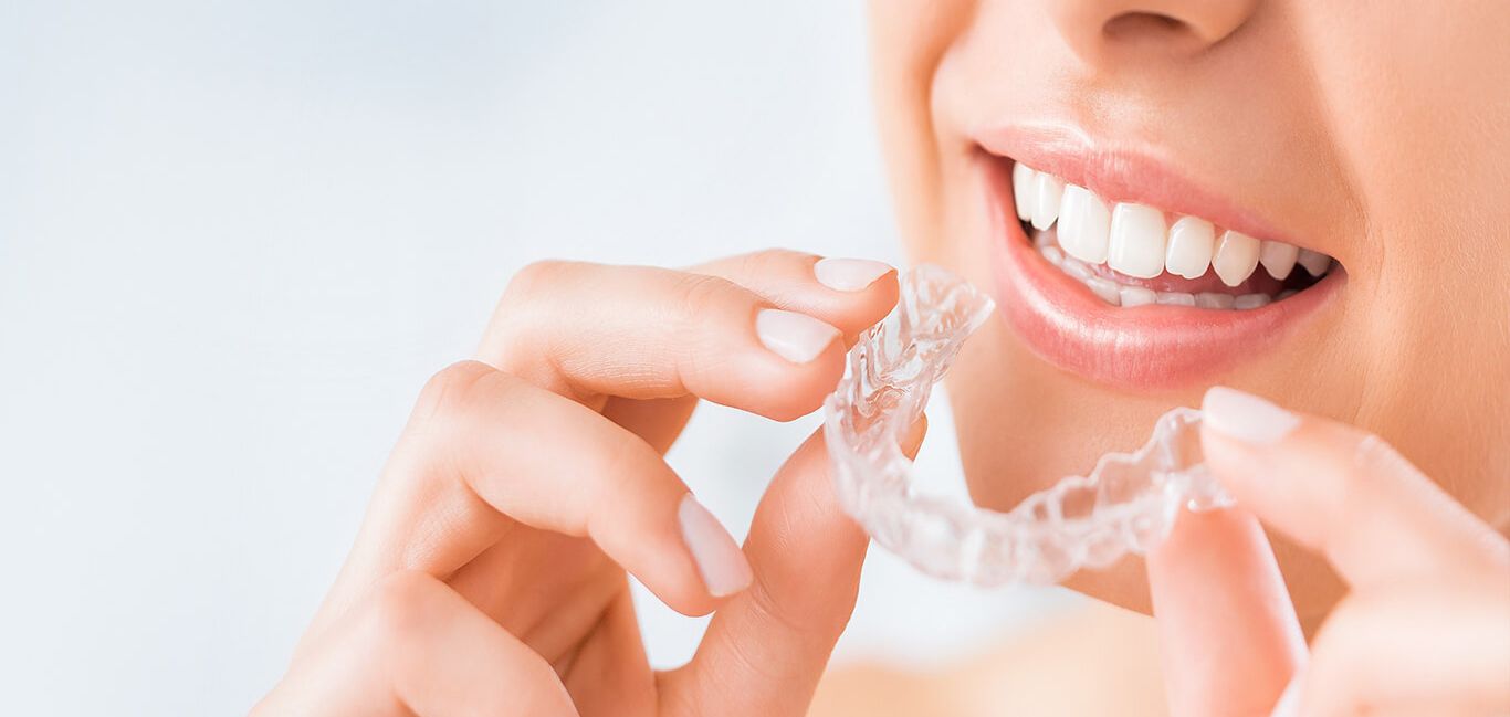 invisalign-braces-cost-in-india