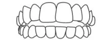 Invisalign Invisalign