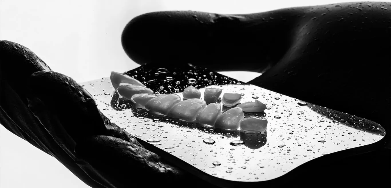 Benefits of Porcelain Veneers veneers